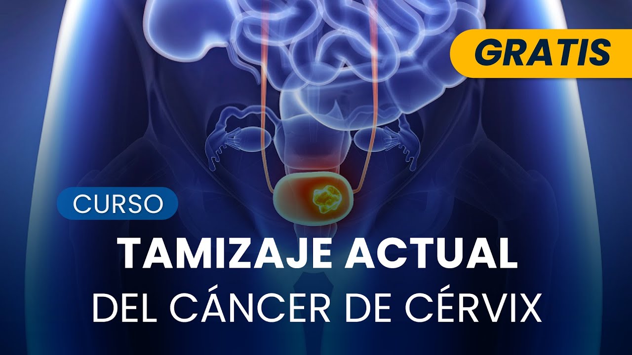 Tamizaje Actual del Cáncer de Cérvix - CERTIFICACIÓN GRATIS