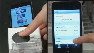 Akıllı telefonlar Aids testi yapacak