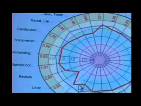 how to cure gdv