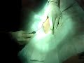 Canula Canula