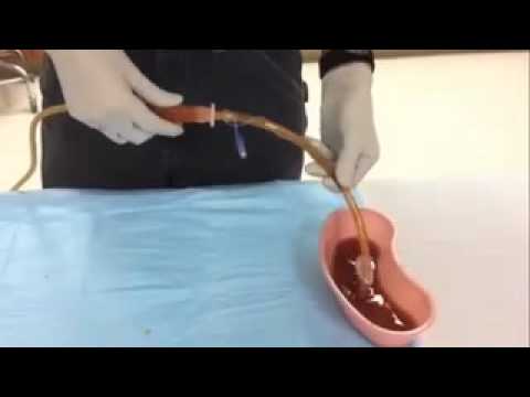 Succus Pulmonicus 1