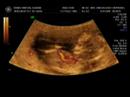 Ecografia de nuestro bebe Muñoz Ibañez Ecografia de nuestro bebe Muñoz Ibañez
