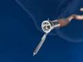 TEMS (Transanal Endoscopic Microsurgery)