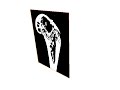 FASTRA Femur