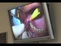 Dental Implants Training: USC Dentistry Continuing Dental Ed