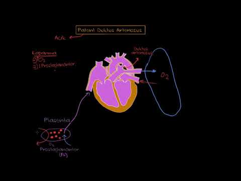 Khan Academy - Patent Duktus Arteriozus (Fen Bilimleri) (Sağlık ve Tıp) - 2020.12.17