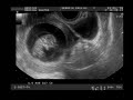 03. 05. 2008