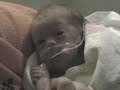 Preemie Boy 25 weeker