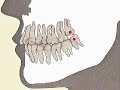 How the Body Works : The Permanent Teeth