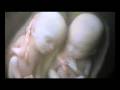 videos de Teaser Twins basse def.mp4