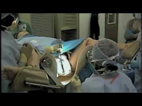 how to perform cervical cerclage