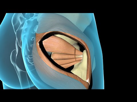 Hip Surgery