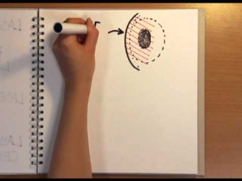 See video