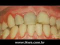 Odontologia - Periodontia - O que �? - Eduardo Rubio