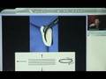李德孚醫師-石英震波療法Piezoelectric  Debridement(試看)