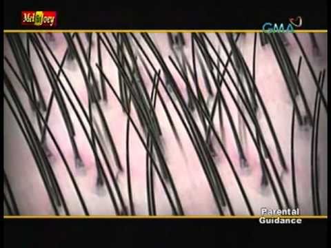 how to apply novuhair