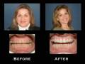 videos de Markham Dentist Office - Family & Cosmetic Dentist in Markham