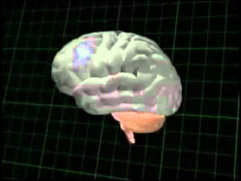 Brain Animation of Epileptic Seizure