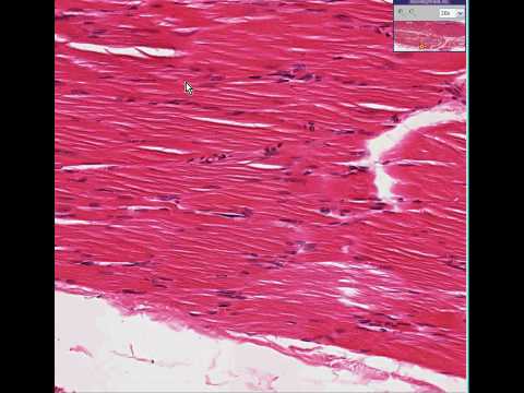 Histopathology Skeletal muscle, ...