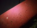 ants devouring some plant