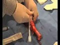 Surgical Airway on resus.com.au
