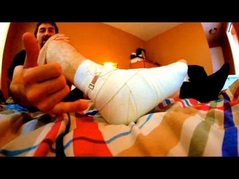 how to recover sprained ankle