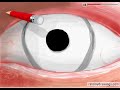 RMD Drawings - Eye