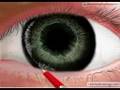 RMD-Drawings-Eye