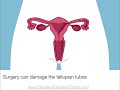 blockedfallopiantubes.com this video explains how to unblock your fallopian tube by traditional Chinese fertility massage combined by some herbal remedies