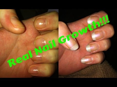 how to grow nails in a week