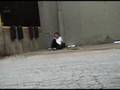 Zach Break Foot