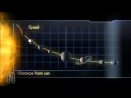 The Dark Matter Mystery: Stars Are Moving Too Fast