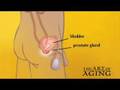 David's Prostate Gland