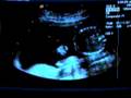 Sluggo, 20 Weeks