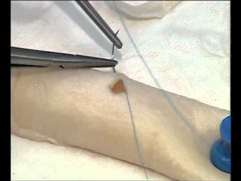 Anastomosis - Wetlab ltd: Cardiac Surgical Skills Laboratory - Proximal Anastamosis Tie Down Technique CABG Cardiac Surgery www.wetlab.co.uk.