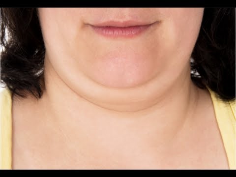 how to get rid my double chin