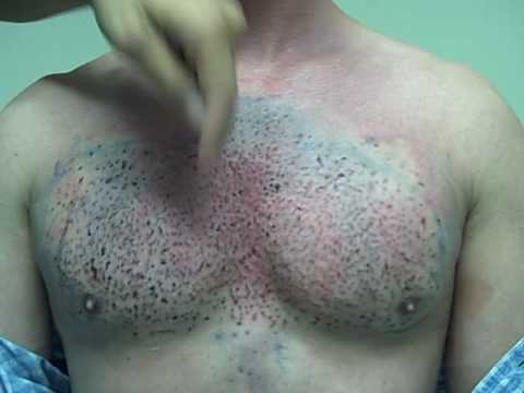 how to grow chest hair