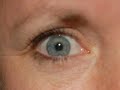 Pupils and Eye