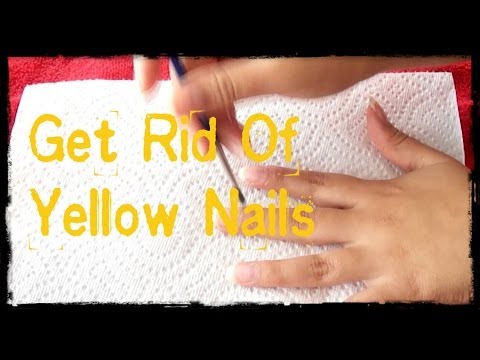 how to get rid yellow toenails
