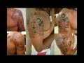 beaut�s ou cicatrices