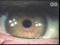 Pink Floyd-Brain Damage, Eclipse