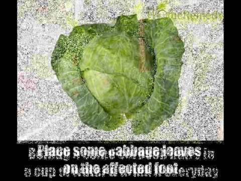 how to relieve edema