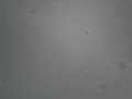 Spermatozoides au microscope zoom optique X40 Spermatozoides au microscope zoom optique X40