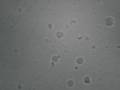 Spermatozoides au microscope zoom optique X40
