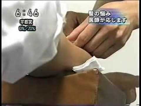 薄毛治療の真実　ＡＧＡには心のケアYoutube(ユーチューブ・ゆーちゅーぶ)・Dailymotion動画