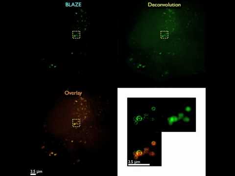 Time lapse movie of a new cell with autophagosomes