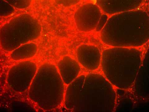 Time-lapse of cell migration and apoptosis during angiogenesis