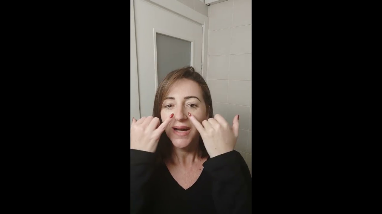 העלמת הקמטים בצידי הפה (מריונטה), לקמטי עישון ולסנטר כפול