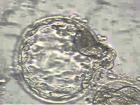 how to decide how many eggs to transfer