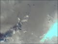Morgellons-Research.Org Video. This video show real moving bacterial fibers. Even stinging them with a needle (needle top 0.2 mm)makes no difference. magnification 50/100